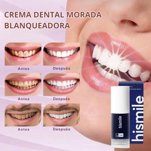 CREMA DENTAL MORADA BLANQUEADORA