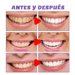 CREMA DENTAL MORADA BLANQUEADORA