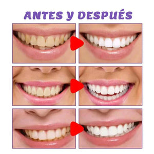 CREMA DENTAL MORADA BLANQUEADORA